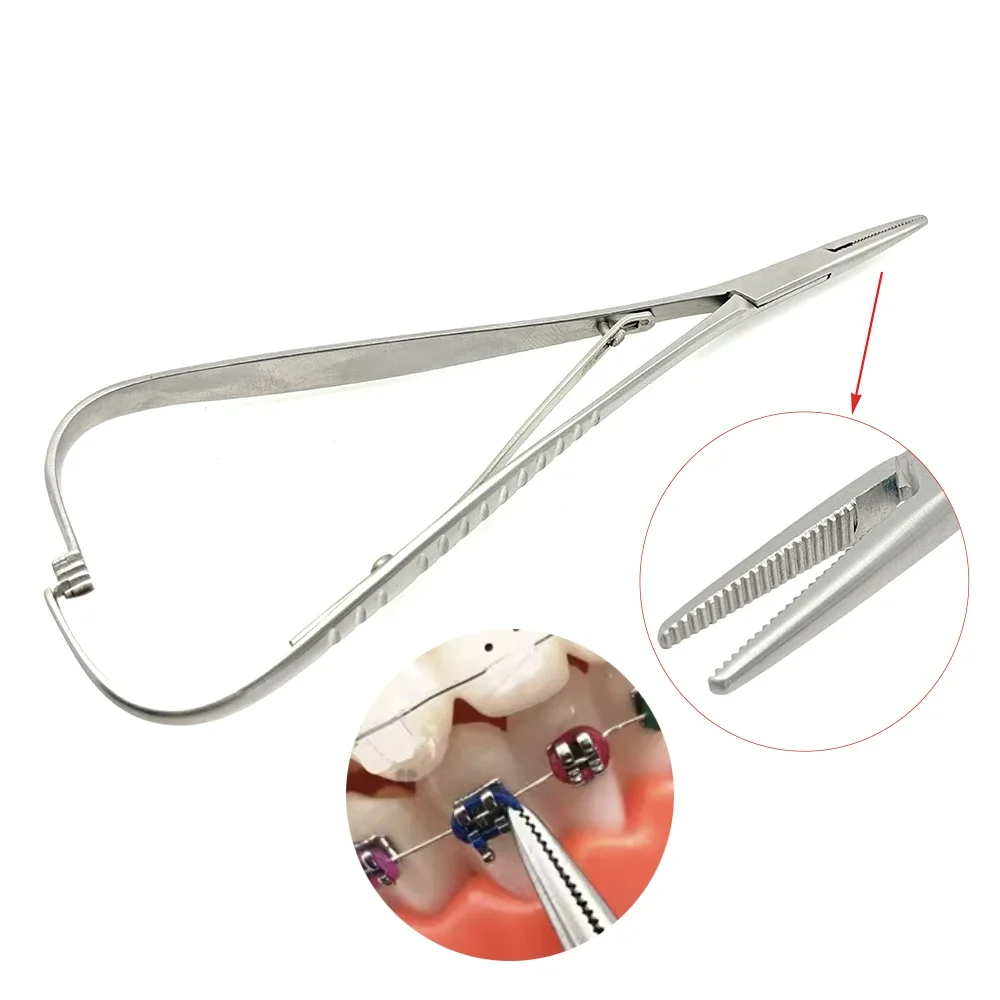 High-Quality Dental Ligature T - Curved Spring Bar recensie en prijs